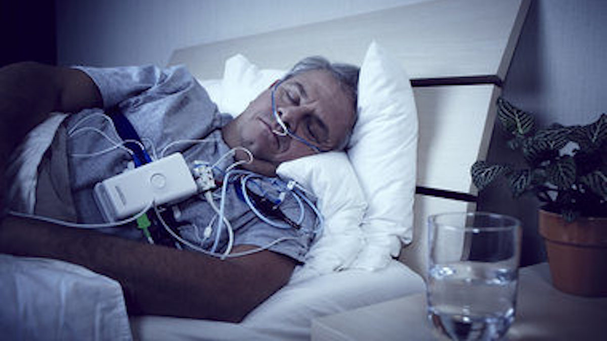 How Long Does It Take To Get Sleep Apnea Test Results